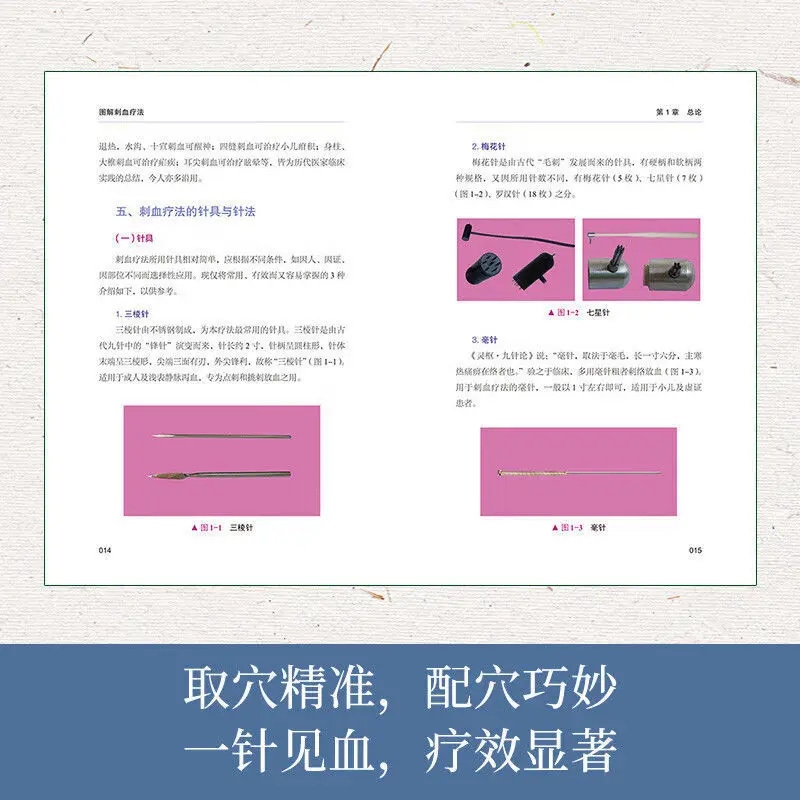 「放血療法」について解説：健康とウェルネスのための伝統中国医 - Therapy Health And Wellness のレビューと価格