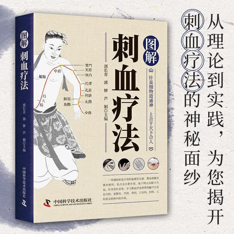 「放血療法」について解説：健康とウェルネスのための伝統中国医 - Therapy Health And Wellness のレビューと価格